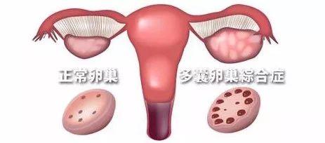 卵巢照片,揭秘女性生殖健康奥秘 第3张 卵巢照片,揭秘女性生殖健康奥秘 第3张