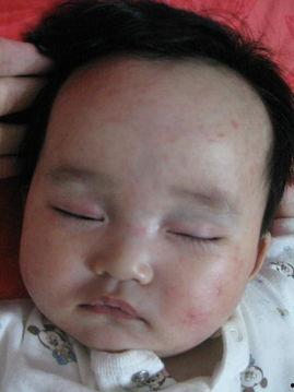 婴儿急诊图片,紧急关头的温馨守护  第3张